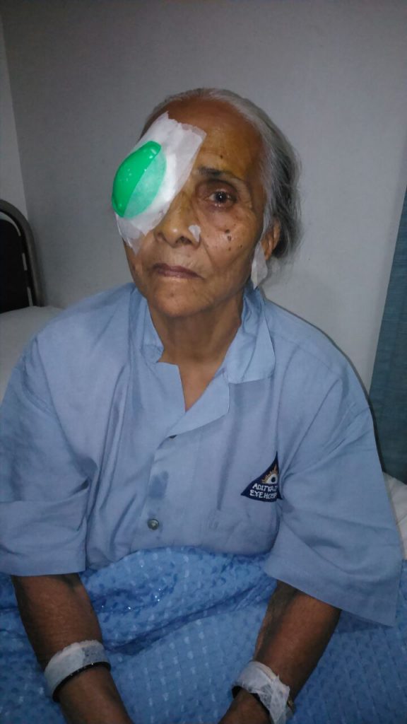Successful completion of cataract surgery of a community member